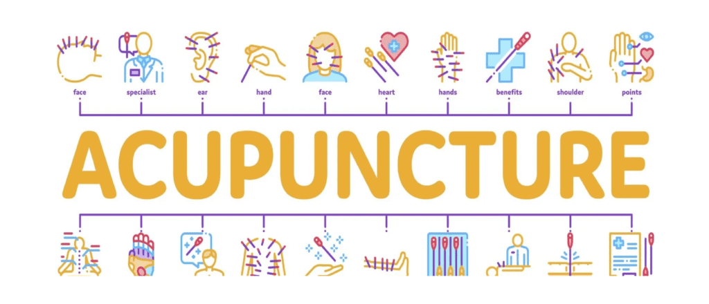 how acupunture works and what its excellent benefits