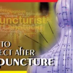 what to expect after acupuncture