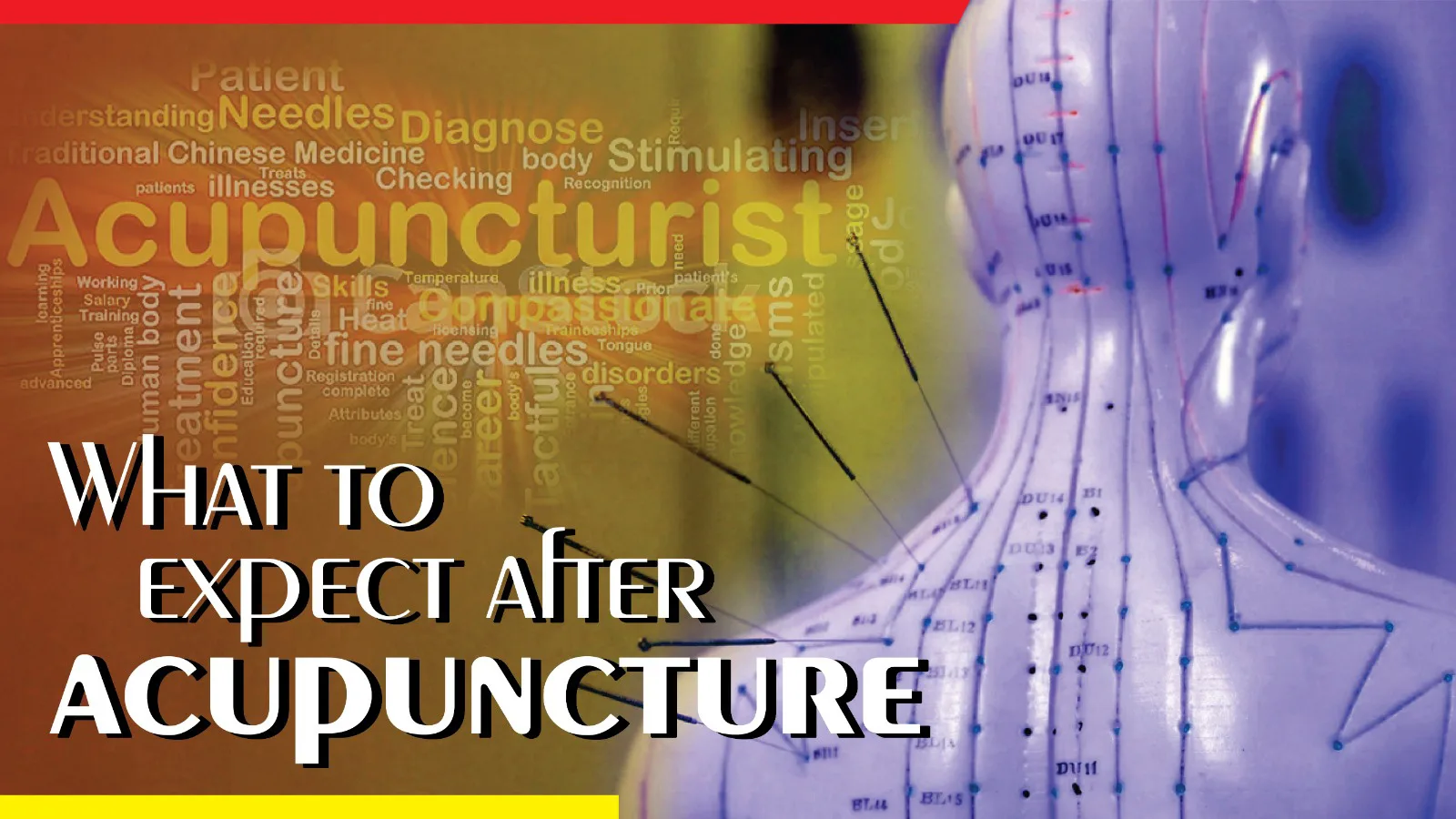 what to expect after acupuncture