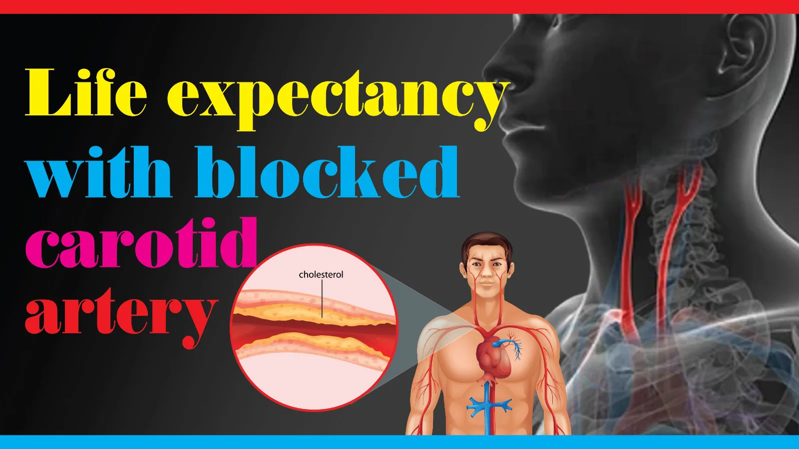 life expectancy with blocked carotid artery