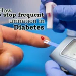 how to stop frequent urination in diabetes