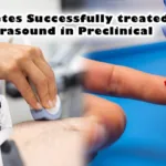 Diabetes successfully treated ultrasound in preclinical: