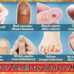 What your toenails say about your health?